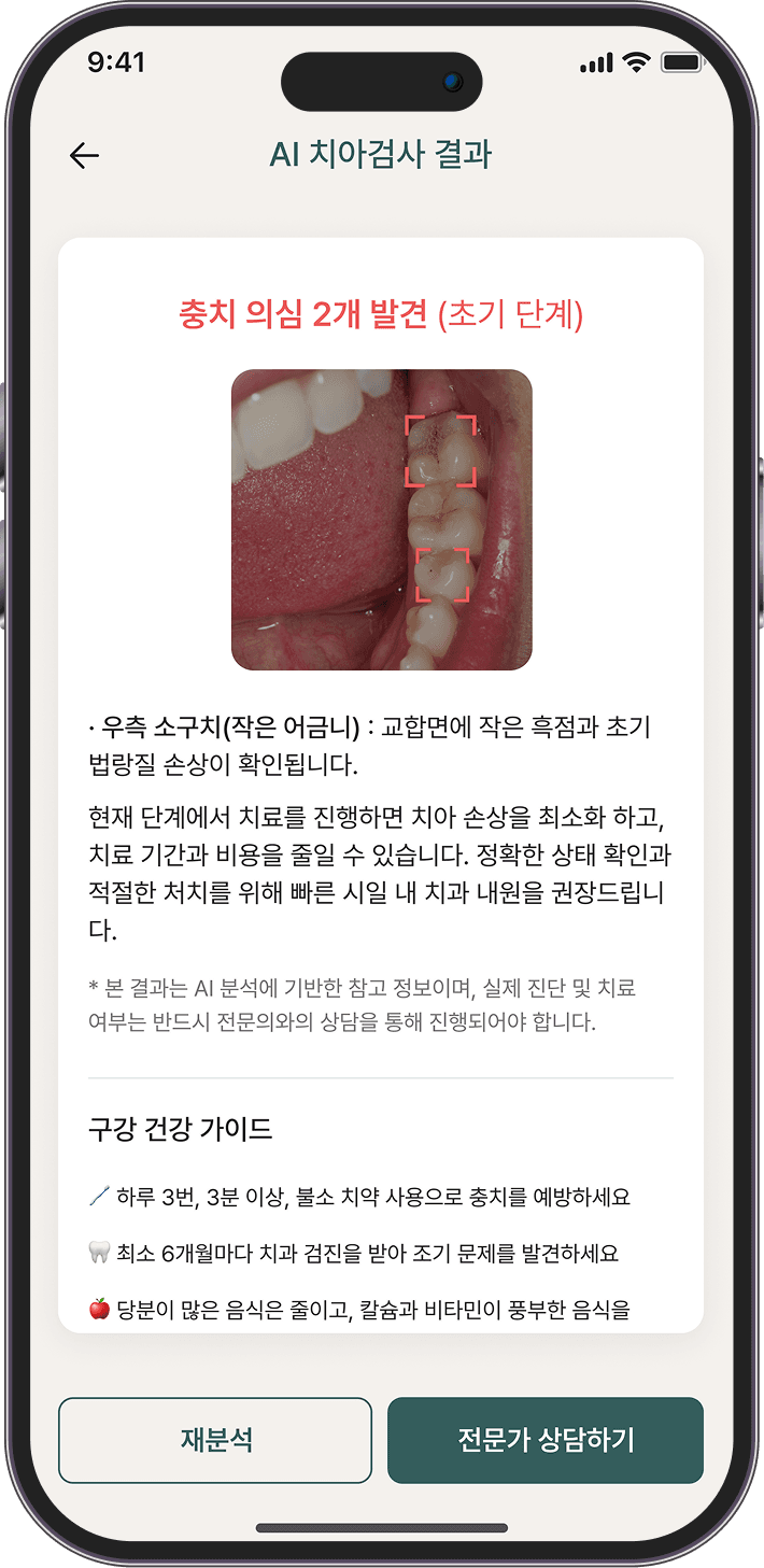 치아 딱 맞게 촬영