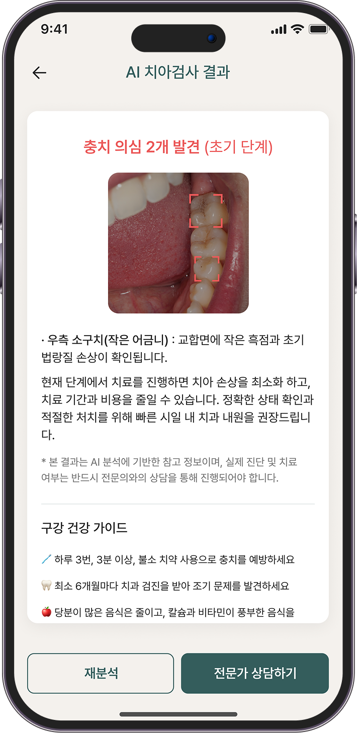 치아, 딱 맞게 촬영